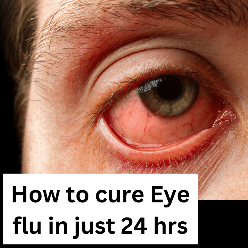 how to cure eye infection in 24 hours